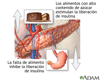 La Diabetes